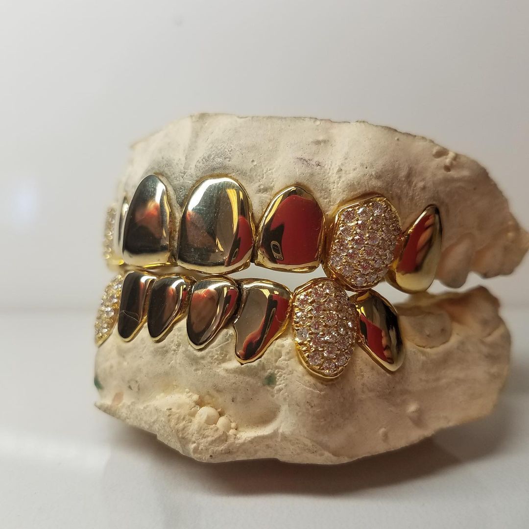 Diamond Grillz, Price is per tooth. Available in 10K, 14K, 18K, & 22K