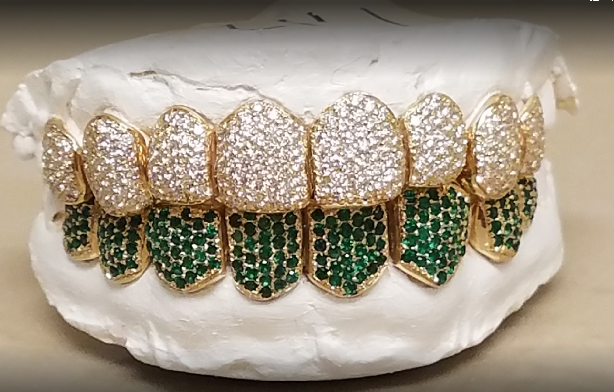 Diamond Grillz, Price is per tooth. Available in 10K, 14K, 18K, & 22K