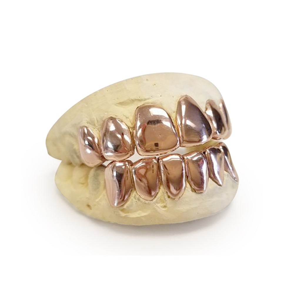 Top & Bottom 10K Custom Gold Teeth – Grillz