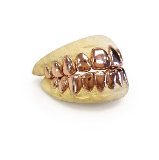 14k Solid Gold grillz  10 top & 10 Bottom teeth - GrillzGodz