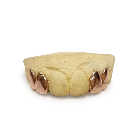 SOLID 10K GOLD: CHOICE OF 4 TOP OR 4 BOTTOM (SPLIT IN MIDDLE)