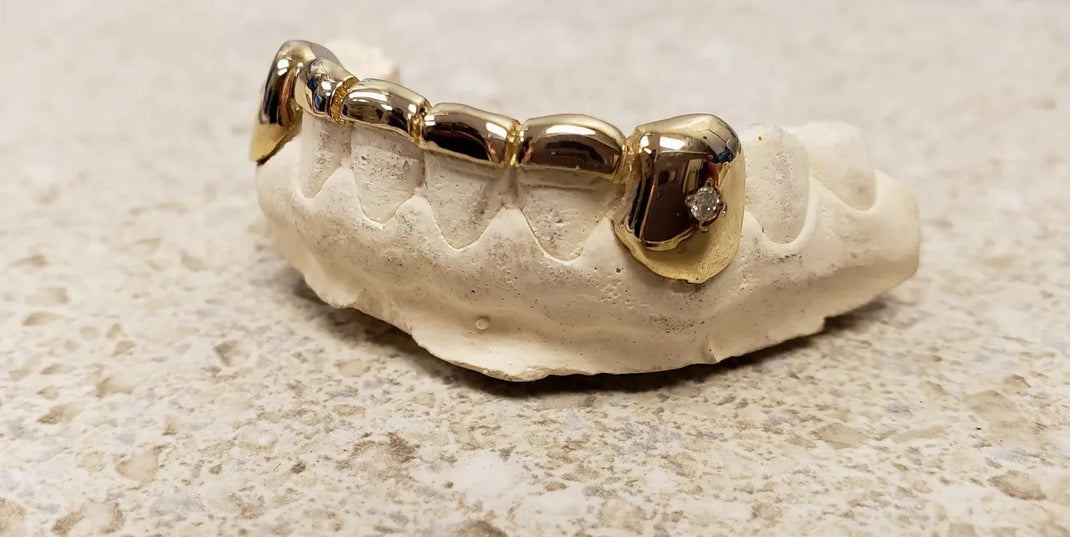 Solid Gold Custom Grillz | Silver & Gold Teeth - Grillz Godz