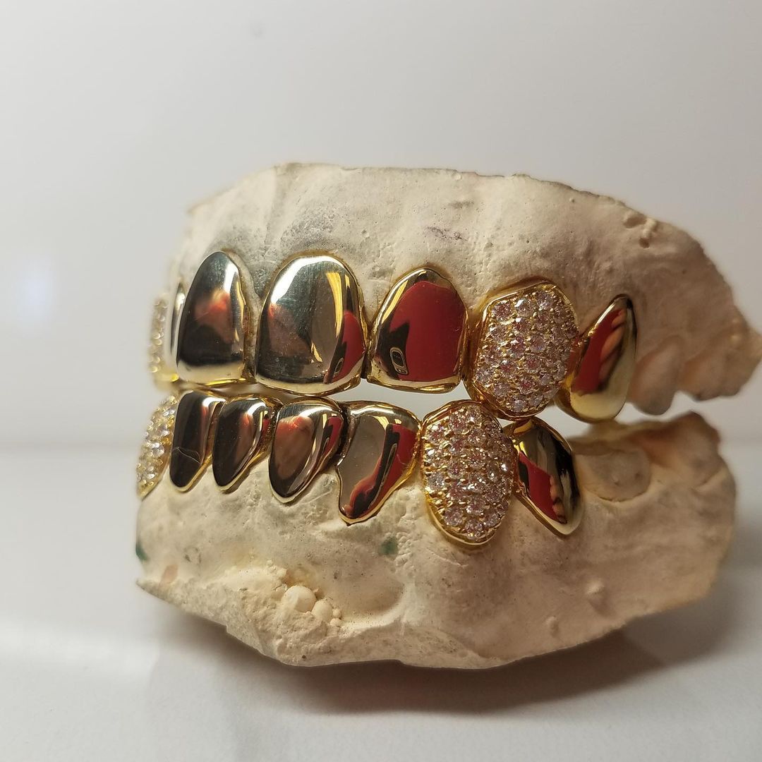 Gold and store diamond grillz