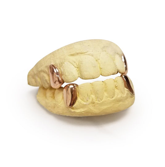 14k Solid Gold grillz choice of 2 top & 2 Bottom - GrillzGodz