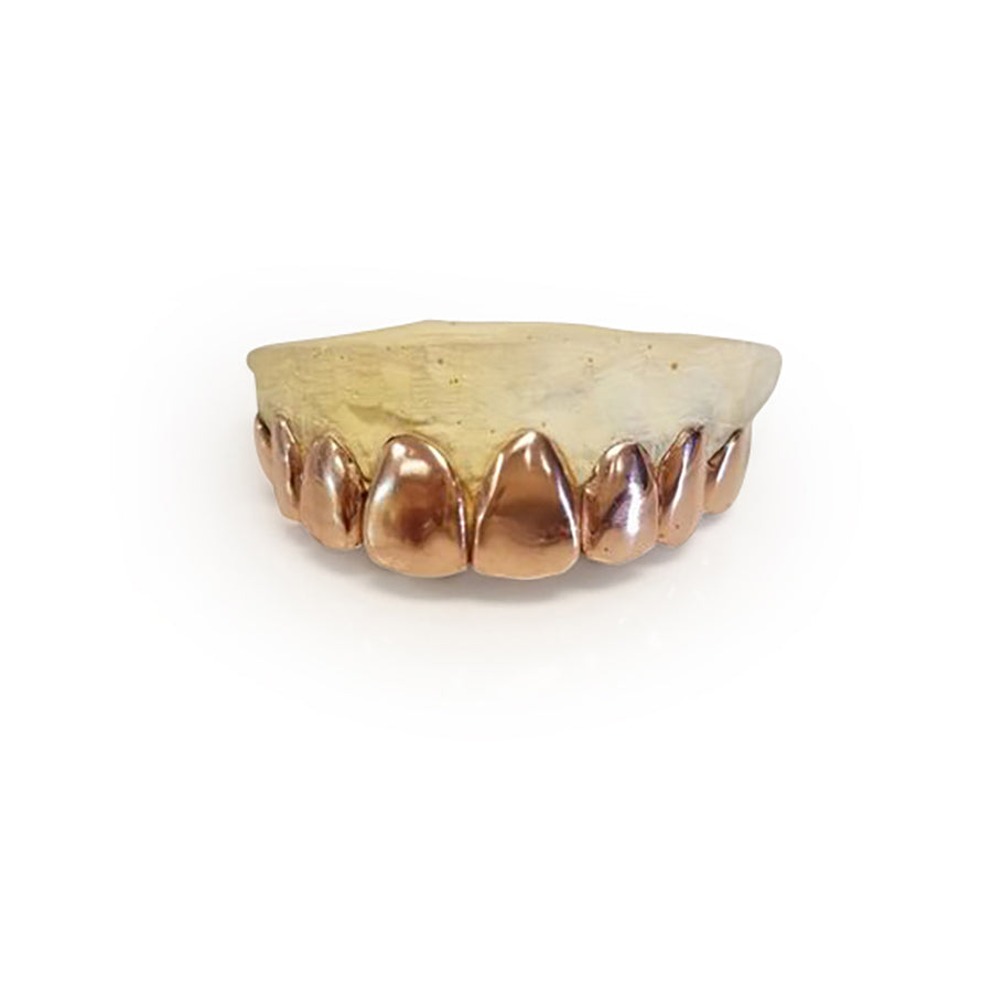 14k Solid Gold grillz choice of 8 top or 8 Bottom teeth - GrillzGodz